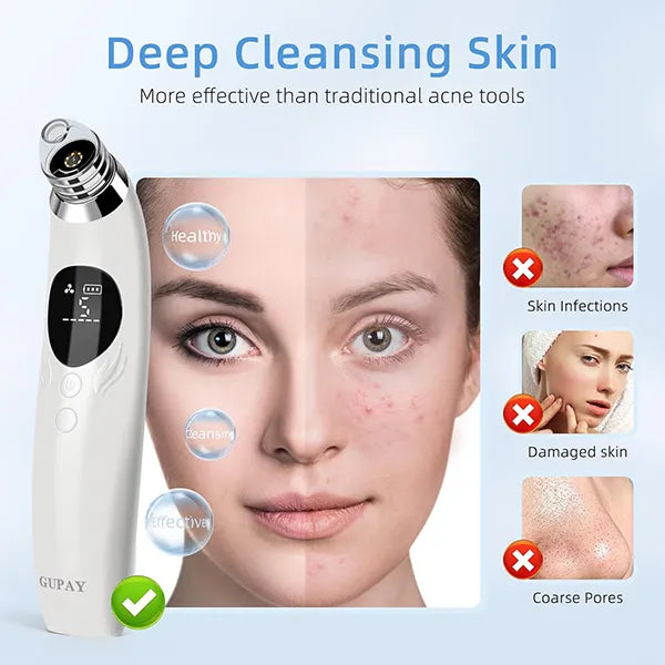 BlaRevia Blackhead Remover Vacuum – 5-Probe Electric Pore Cleaner for Women & Men