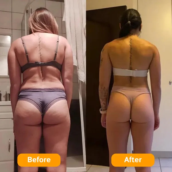 Z3 ZemoKL Cellulite Remover US8390