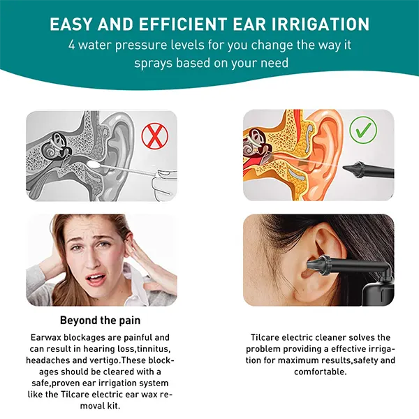 DomiE5 Electric Ear Wax Removal Kit – Water-Powered Irrigator, 4 Pressure Modes, 6-Piece Kit, USB Rechargeable, Waterproof