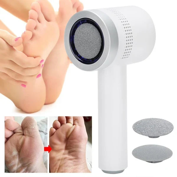 N2 ReCalus Foot Callus Remover