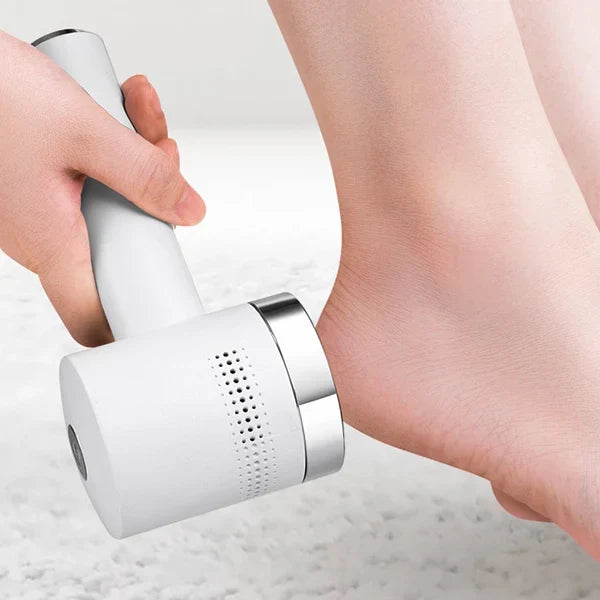 N2 ReCalus Foot Callus Remover