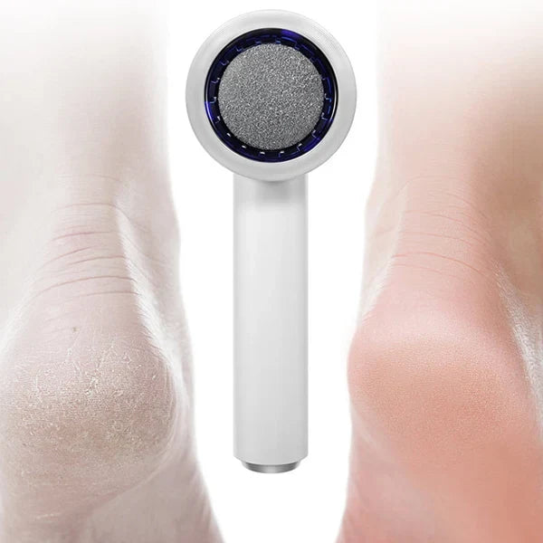N2 ReCalus Foot Callus Remover