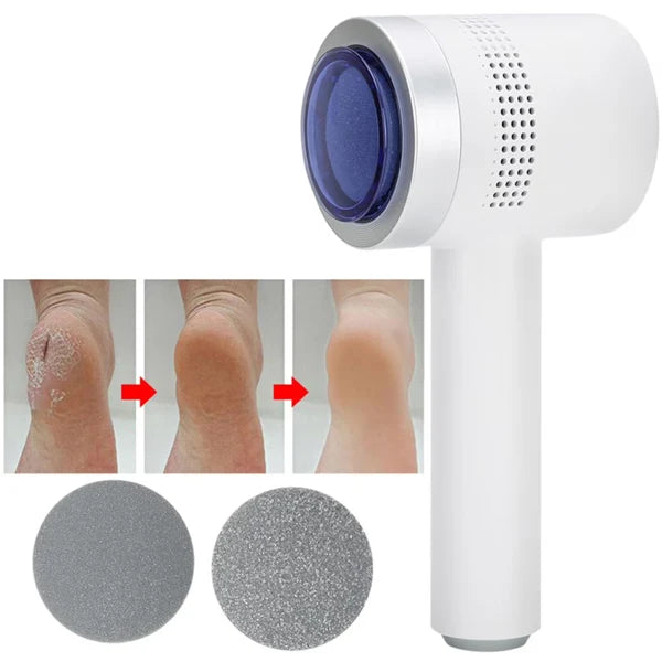 N2 ReCalus Foot Callus Remover