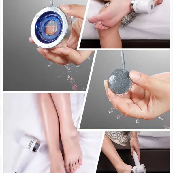 N2 ReCalus Foot Callus Remover